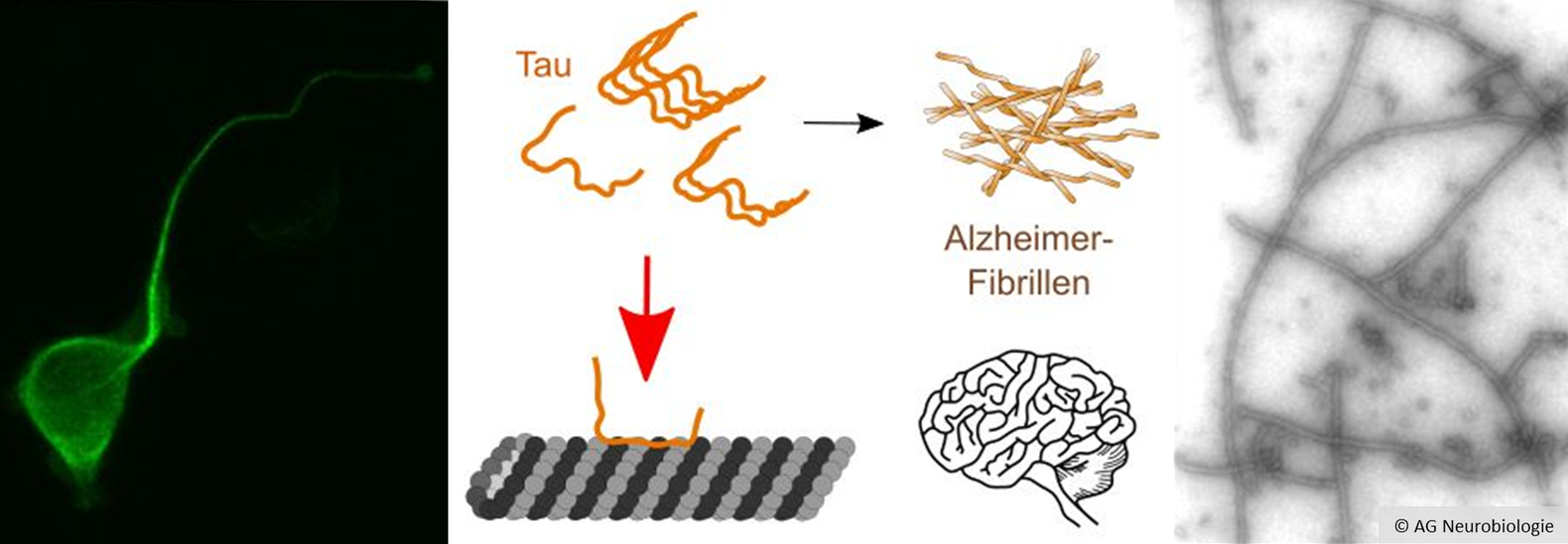 A triple collage; left: A glowing green cell against a black background; centre: a schematic representation of clumping tau proteins; right: a microscopic image shows elongated structures.